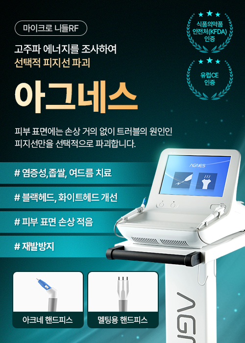 아그네스