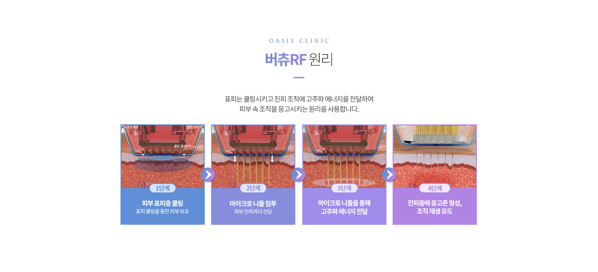 버츄RF 원리