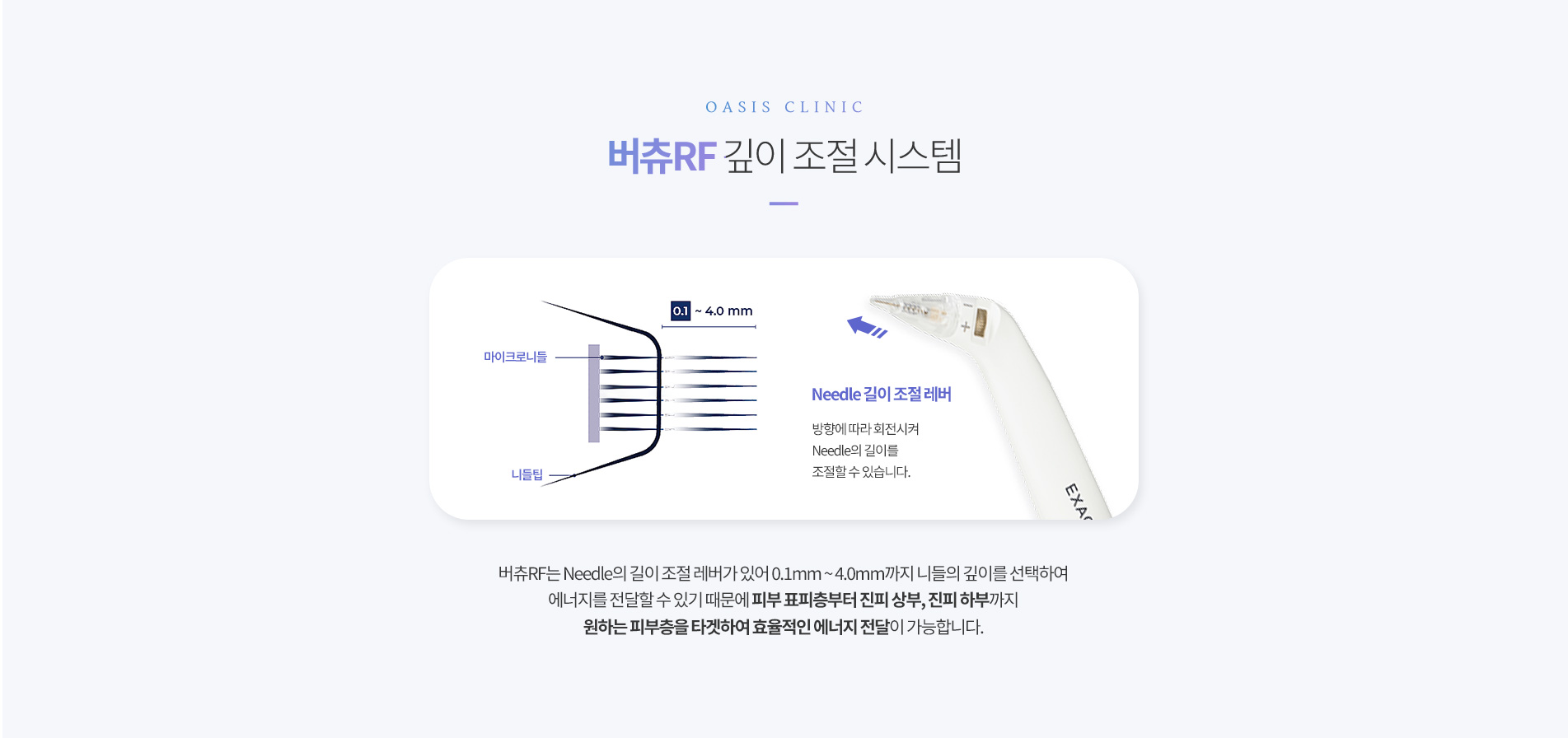 버츄RF 깊이조절시스템
