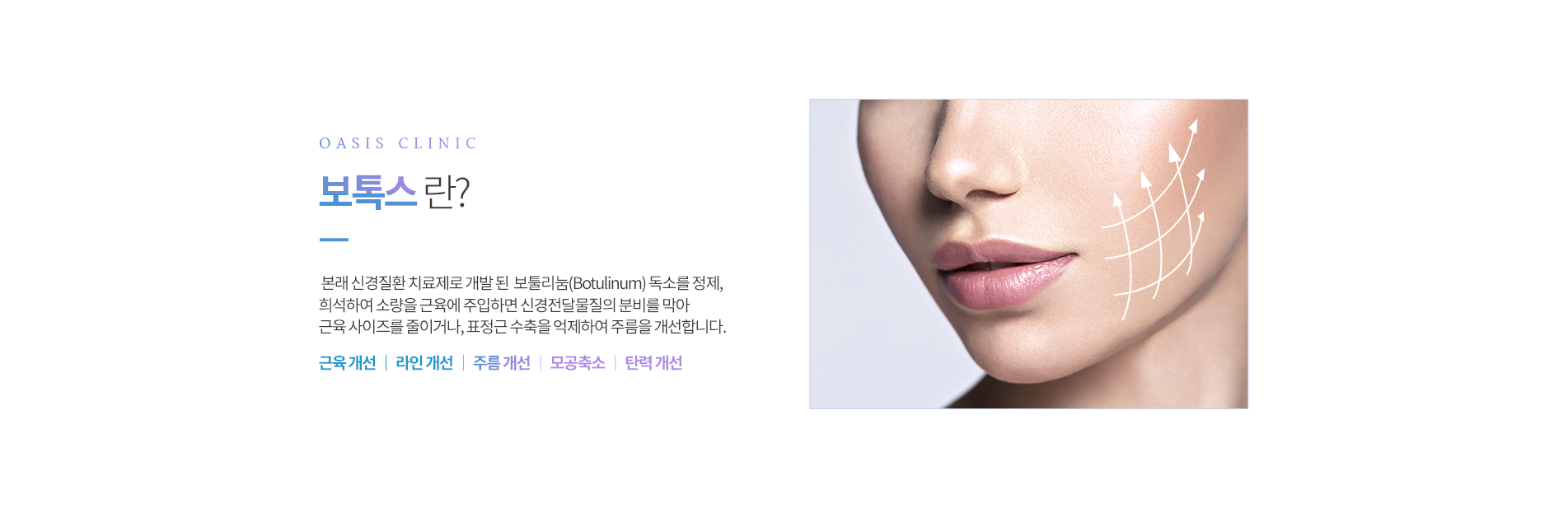 보톡스란?