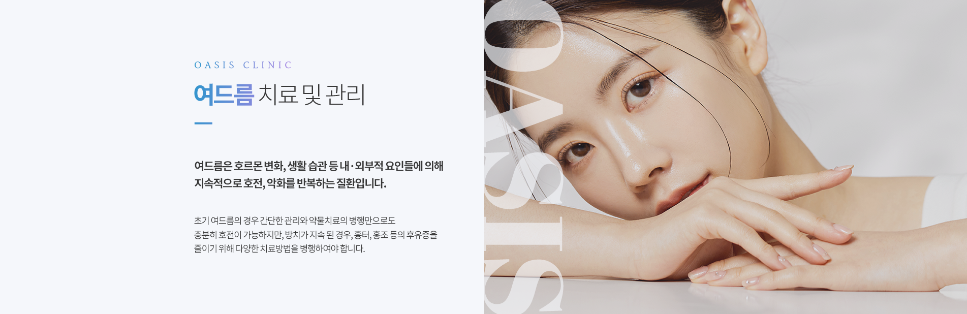 여드름 치료 및 관리