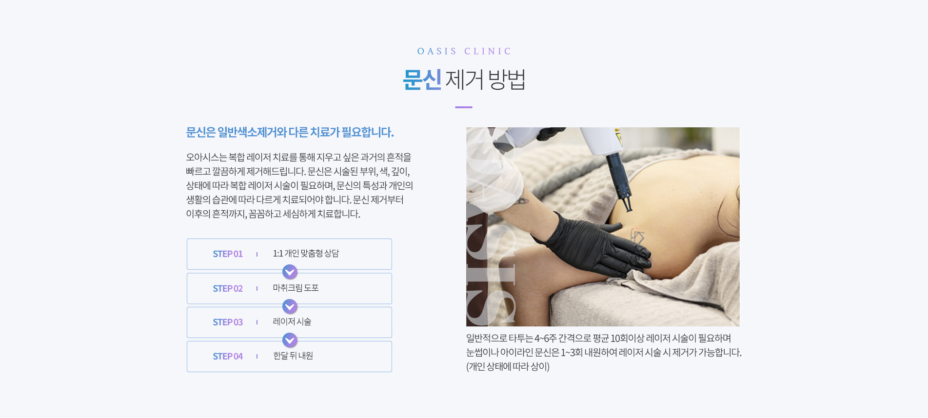 문신제거 방법